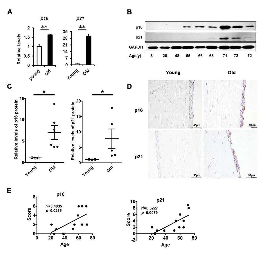 Senescence associated markers rise with age in human corneal epithelium. (A) The mRNA expression of p16 and p21 in young donors(≤30 years of age) and old donors (≥50 years of age) corneal epithelium(**P≤0.01, n=3).(B) Immunoblot analysis of p16 and p21 in the corneal epithelium during aging. (C) Quantification of western blots processed with Image J. (D-E) Representative photographs (D) and histopathology scores (E) for the IHC staining of p16 and p21 in corneal epithelium from donors of different ages. There were statistically significant differences in p16 and p21 expression between the donors of younger than 30 years and older than 50years of age (P≤0.05). The figure depicts a Pearson correlation of p16 and p21 protein expression with age (E).