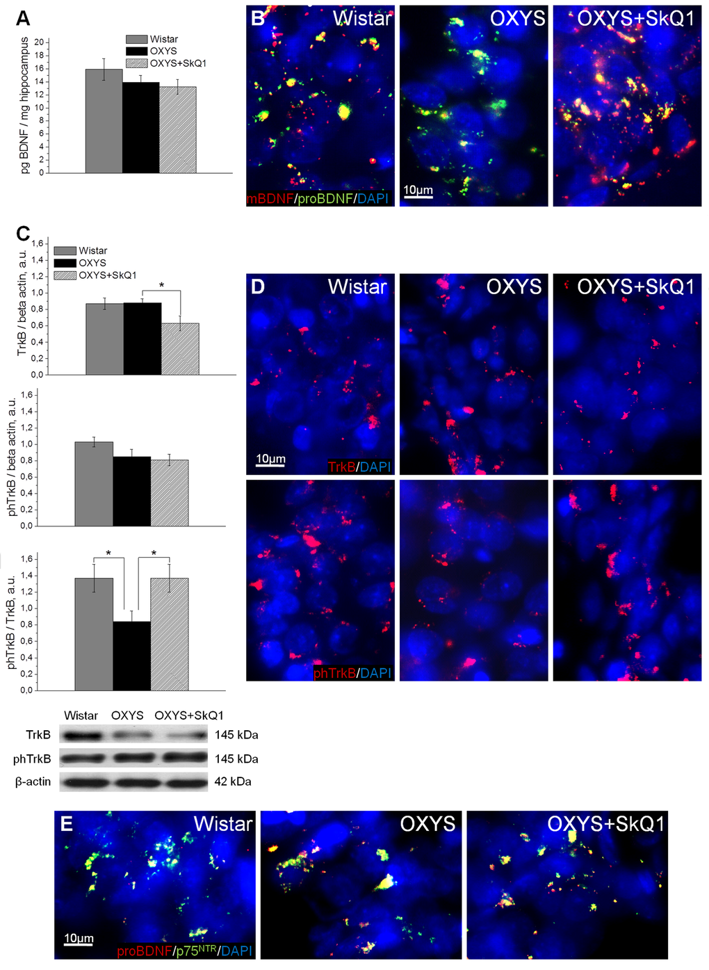 SkQ1 improves neurotrophic supply in the hippocampus. (A) Enzyme immunoassay analysis showed no differences in the levels of total hippocampal BDNF among 18-month-old Wistar rats, untreated OXYS rats, and SkQ1-treated OXYS rats (n=8). (B) Representative 40 × immunofluorescent images of staining for mBDNF (red), proBDNF (green), and cell nuclei (DAPI, blue) in the CA1 region of the hippocampus. (C) Hippocampus levels of TrkB and phTrkB were not different between Wistar rats and untreated OXYS rats (n=6). The level of TrkB decreased in the hippocampus of SkQ1-treated OXYS rats (pD) Representative 40× immunofluorescent images of staining for receptors TrkB (red; upper row) and phTrkB (red; lower row) and for cell nuclei (DAPI, blue) in the CA1 region of the hippocampus. (E) Representative 40× immunofluorescent images of colocalization of proBDNF (red), p75NTR receptor (green), and cell nuclei (DAPI, blue) in the CA1 region of hippocampus. A.u.: arbitrary units. The data are shown as mean ± SEM. Statistical significance (p