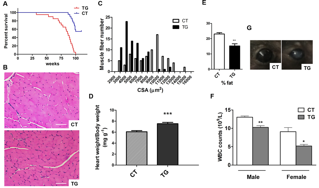 (A) Longevity in control (n=23) and COX2 transgenic (n=25) mice. (B) H&E stained sections of hind leg skeletal muscle from 22-week-old control (CT) and COX2 transgenic (TG) female littermates. Cross sections of the extensor digitorum longus (EDL) muscle are shown. Scale bar=100 μm (C) Frequency distribution of skeletal muscle fiber cross-sectional area (CSA) between control (CT) and COX2 transgenic (TG) mice. (D) Heart weight/body weight (HW/BW) ratios in tamoxifen-induced control (CT) and COX2 transgenic (TG) male littermates at the age of 22 weeks. HW/BW ratios in COX2 transgenic mice were significantly higher than those in control mice (paired t-test, pE) Quantitative assessment of fat content by X-ray densitometry of control (CT) and transgenic (TG) mice (n=5). (F) White blood cell (WBC) counts in tamoxifen-induced control (CT) and COX2 transgenic littermates (paired t-test, *: pG) The opacity of cornea developed in COX2 transgenic (TG) mice.