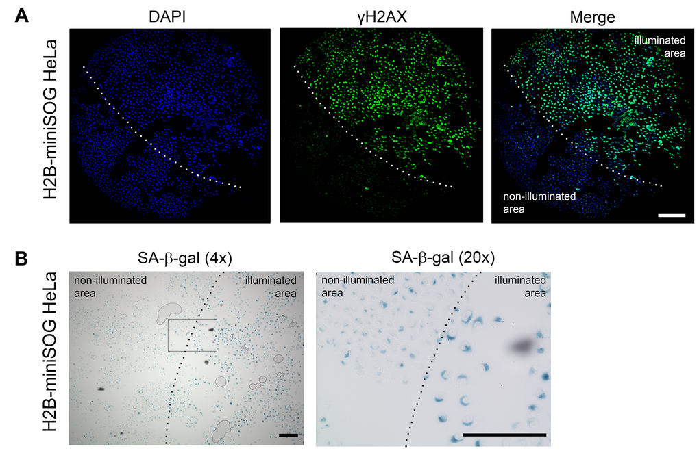 Locally activated H2B-miniSOG can induce cellular senescence. (A-B) HeLa cells expressing H2B-miniSOG were synchronized in S phase, illuminated with blue (465-495 nm, 65 mW/cm2, 5 min) light, allowed to recover for 24 hr, and stained for γH2AX (A) or SA-β-gal (B). Only part of each specimen was illuminated. Dashed line shows the boundary between illuminated and non-illuminated parts of the specimens. Scale bars: 100 µm (A) and 80 µm (B).