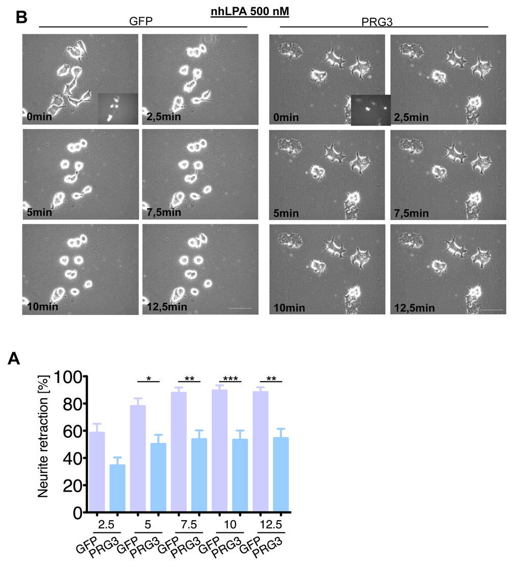 PRG3 impedes non-hydrolysable lysophosphatidic acid (LPA) induced axon collapse. (A) Representative time laps microscopy image series of GFP and PRG3 expressing neurons treated with 0.5 µM nhLPA (non-hydrolysable lysophosphatidic acid, which is resistant to any ecto-phosphatase activity). Transfection efficacy is shown in first image bottom right corner. Scale bar represents 50 µm. (B) Quantification of neurite length of neurons expressing GFP (control) or PRG3. Note, that PRG3 expressing neurons are also resistant to the nhLPA collapse inducing activity. Three independent experiments were carried out and differences were considered statistically significant with * pt-test). Values are given as mean ± SEM.