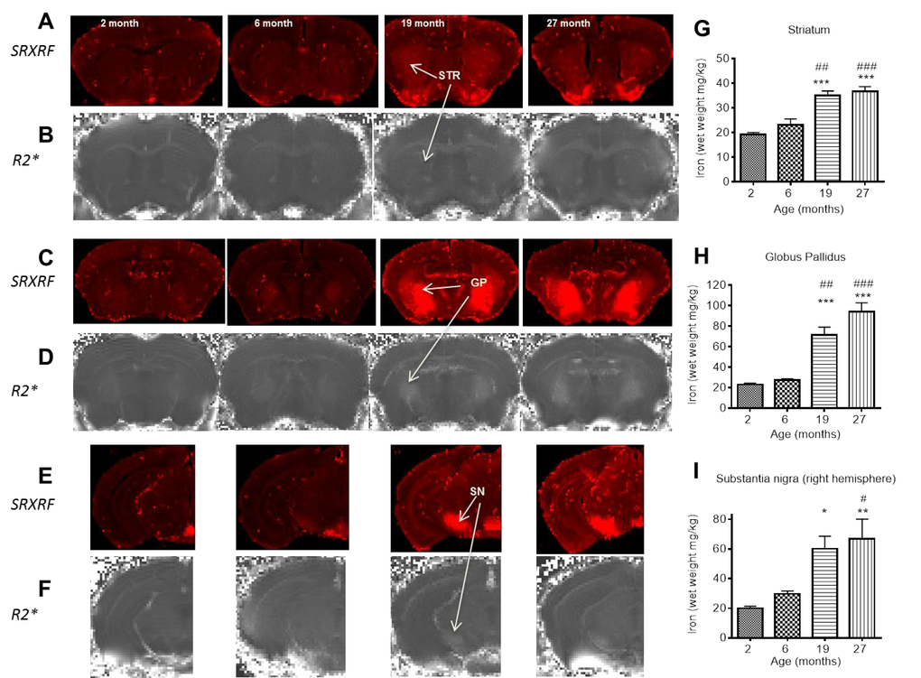 SRXRF elemental iron maps in (A) striatum, (C) globus pallidus and (E) substantia nigra with corresponding R2* maps in (B), (D) and (F) at 2, 6, 19 and 27 months. [Arrows highlight clear accumulation of iron concordant with increased R2*, most prominent between 6 and 19 months.] Qualitative increases in iron are accompanied by significant quantitative increases in iron, largely between 6 and 19 months in (G) striatum, (H) globus pallidus and I) substantia nigra. Significance level at *, P P  P P P  P 