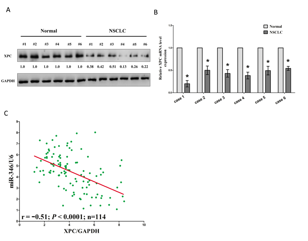 Expression of XPC is up-regulated in primary human lung cancer and negatively expressed related to miR-346. (A-B) Western-blot of XPC protein and qRT-PCR of XPC mRNA in lung cancer tissues and adjacent-normal lung cancers. n=114 for each group. C. Scatter plots showing the inverse association between miR-346 level and XPC mRNA expression. *P 