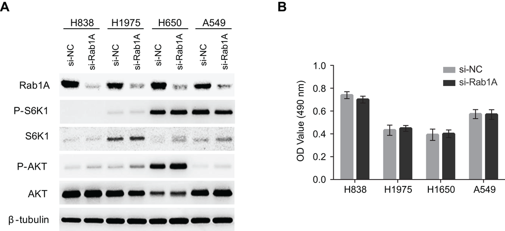 Rab1A does not regulate mTOR signaling or cell growth in lung cancer. (A) The effects of Rab1A knockdown was examined in H838, H1975, H650 and A549 cells by immunoblot. Levels of P-S6K1 (T389), S6K, P-AKT (S473) and AKT are shown. β-tubulin was used as a loading control. (B) Rab1A was knocked down in H838, H1975, H650 and A549 cells. The relative growth of these cells was analyzed using an MTT assay. Data represent means ± SD of three independent triplicate experiments. si-NC, negative control siRNA; si-Rab1A, Rab1A-specific siRNA.
