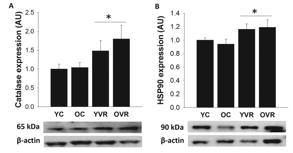 Voluntary aerobic exercise augments arterial markers of antioxidant defense and stress resistance. Aortic protein expression of catalase (A) and Hsp90 (B) in arteries from young control (YC), old control (OC), young voluntary wheel running (YVR) and old voluntary wheel running (OVR) mice. Representative images are presented below each panel with corresponding images of normalizer (beta actin) taken from the same region of the same blot. Data are presented normalized to beta actin and relative to the mean of the YC group as means with error bars representing SEM, n=6-8/group. * p