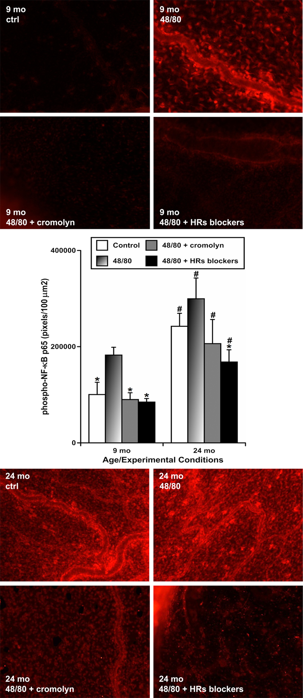 Effects of chemically-induced (compound 48/80) activation of mesenteric mast cells on activation of NF-κB in mesentery close to mesenteric lymphatic vessels in adult (9 mo, n=4 for control and n=4 for each treatment group) and aged (24 mo, n=4 for control and n=4 for each treatment group) rats without and with coinciding blockade of mast cell activation by cromolyn, or blockade of all types of HRs using a mixture of HR blockers. Upper panels – representative images of adult (9-mo) mesenteric segments labeled for phospho-NF-κB p65 (in red) in sham (ctrl) conditions and following treatment with 48/80, 48/80 with cromolyn and 48/80 with HR blockers. Lower panels demonstrate images of aged (24-mo) mesenteric segments labeled for phospho-NF-κB p65 (in red) after the similar treatments. Graph in the middle shows a comparison of pixel intensity of phospho-NF-κB p65 per 100 μm2 under various conditions in the two age groups. * indicates significant difference (p 