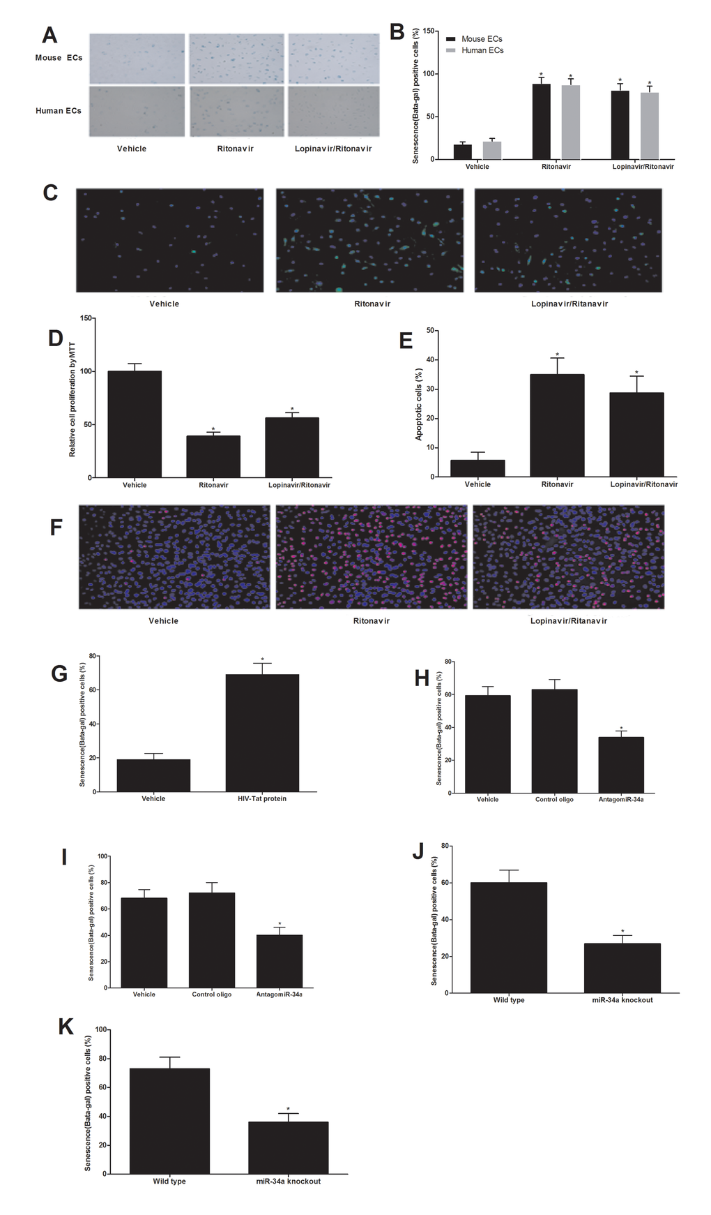 Both antiretroviral agents and HIV-Tat protein induce senescence of ECs, which could be inhibited by miR-34a knockdown or miR-34a knockout. Antiretroviral agents ritonavir (7.5 µmol/L), or lopinavir (10 µmol/L) plus ritonavir (2 µmol/L) (lopinavir/ritonavir) could induce EC senescence as shown by the increased beta-gal staining (A and B), increased ROS production (C), decreased EC proliferation (D) and increased apoptosis induced by H2O2 (100 µM) (E and F). EC senescence was enhanced by HIV-Tat protein (100 nM) as shown by the increased beta-gal staining (G). Both antiretroviral agents (H) and HIV-Tat protein (I) induced senescence of ECs could be inhibited by miR-34a knockdown AntagomiR-34a (30 nM). The ECs from miR-34a knockout mice were resistant to antiretroviral agents (J) and HIV-Tat protein (K) induced senescence of ECs. Note: n=6; *p