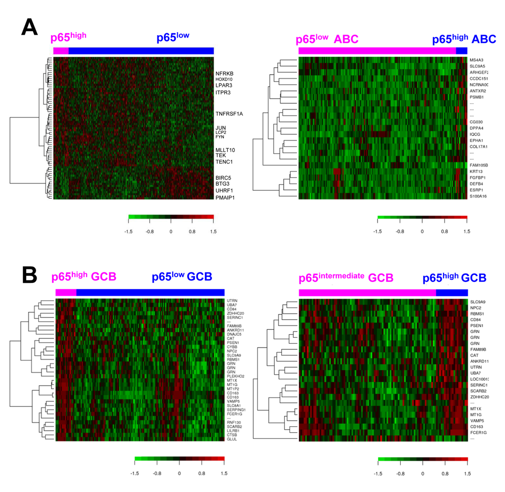 Gene expression analysis for p65 hyperactivation in diffuse large B-cell lymphoma (DLBCL). (A) Heatmaps for gene differentially expressed between p65high (IHC ≥50%) and p65low (IHC B) Heatmaps for genes differentially expressed between p65high (IHC ≥50%) and p65low (IHC high (IHC ≥50%) and p65intermediate (IHC 10-40%) patients with germinal center B-cell–like DLBCL (false discovery rate 