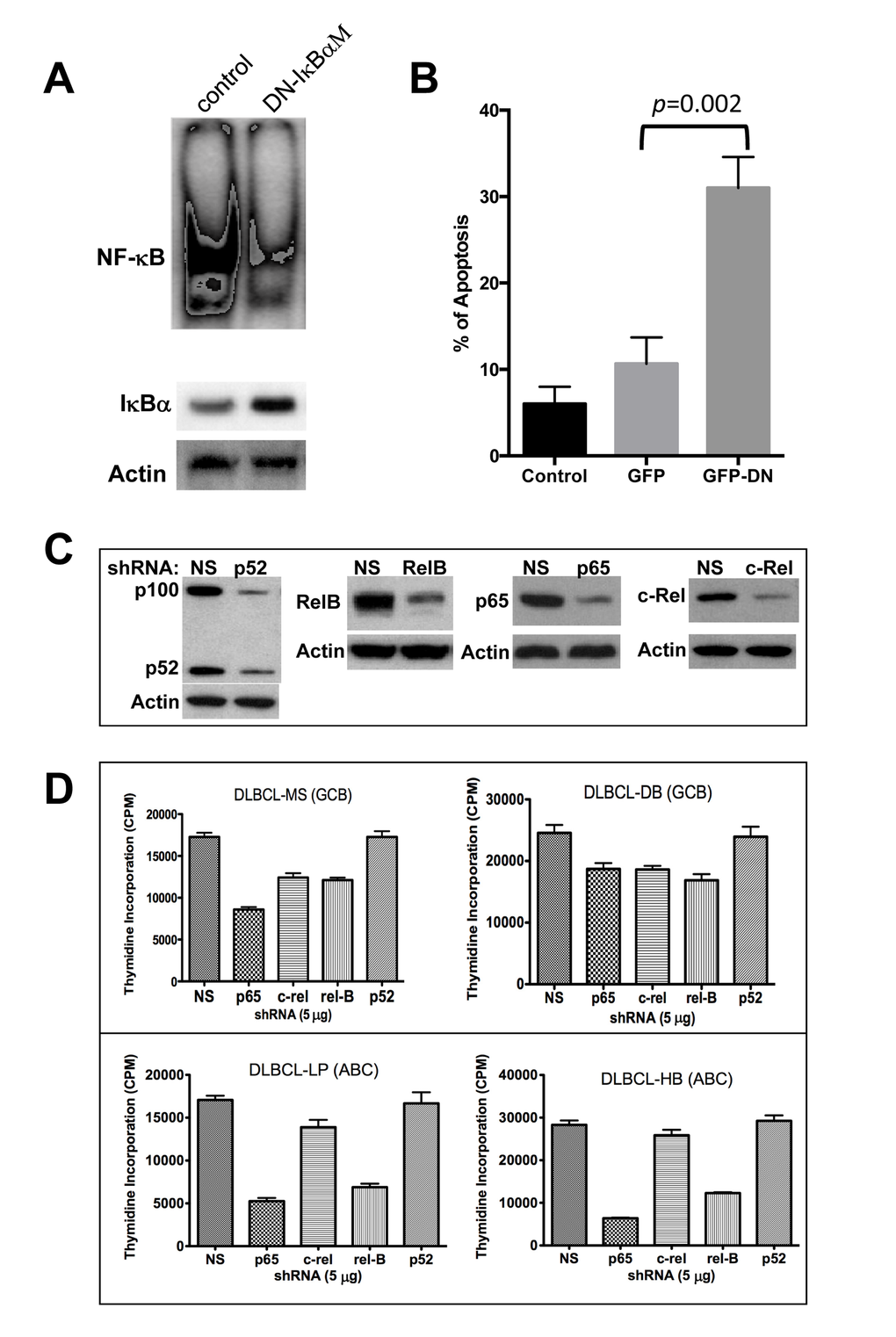 Molecular targeting of NF-κB in diffuse large B-cell lymphoma (DLBCL) cell lines. (A) DLBCL-MS cells were transfected with empty control vector or a pCMV-ΙκBαM vector for 24 hrs. Nuclear extracts (10 μg) were analyzed for NF-κB expression by EMSA. Cytoplasmic extracts were assessed for ΙκBα and actin protein expression by Western blotting. (B) Transfected cells from part A were also assessed for apoptosis after 24 hours of incubation using annexin V assays. (C) MS cells were transfected with plasmids expressing the p52, RelB, p65, c-Rel, or a non-specific (NS) shRNA. Forty-eight hours post-transfection, proteins were extracted and analyzed for NF-κB component inhibition by Western blot. (D) Indicated DLBCL cell lines were transfected with the validated green fluorescent protein (GFP)-plasmid–based shRNA for each of the NF-κB subunits. After 16 hours, GFP–positive cells were sorted and assessed using proliferation assays. Data represent two independent experiments with triplicate samples. Abbreviations: GCB, germinal center B-cell–like; ABC, activated B-cell–like, DN, dominant negative.