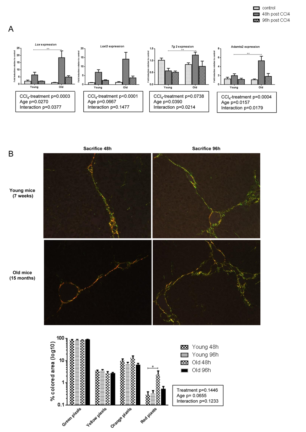 More pronounced collagen cross-linking process in old mice. (A) Hepatic genes expression of Lox, Loxl2,Tg2 and Adamts2 (Mean ± SEM) (n=6/group). (B) Sirius red stained sections were observed under polarized light microscopy (200x magnification) to evaluate fiber thickness according to their color. The four different colored collagen fibers were quantified by morphometrical analysis (see methods) (n=6/group). Statistical analysis was performed by two-way ANOVA for repeated measures (boxes) followed by Bonferroni’s post-hoc correction. *P