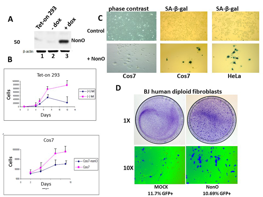 Overexpression of NonO promotes senescence of transformed and primary cells. (A) Cell lysates from Tet-on 293 (lane 1), a clone stably transfected with NonO in the presence (lane 3) and absence (lane 2) of tetracycline, were confirmed for OE by SDS-PAGE/anti-NonO western blotting. Error bars represent average of 3 independent measurements. (B) Growth rate retardation following NonO overexpression. An inducible clone of Tet-on 293 (upper panel) or Cos7 (lower panel) was plated on day 0 at 10,000 cells/well in the presence (+) and absence (-) of tetracycline and harvested for cell counting as plotted as a function of time on a log scale. Error bars represent average of 3 independent measurements. (C) NonO overexpression promotes senescence of 293T and Cos7 cells, as measured by SA-β-gal staining. Empty vector (mock, upper panels); NonO overexpression (OE, bottom panels). Photographs are at the same magnification. (D) Overexpression of GFP-NonO promotes senescence of human diploid BJ fibroblasts. SA-β-gal staining indicated in blue of mock (left) and GFP-NonO (right) at day 12 following stable transfection/G418 selection. Magnification of 1 and 10X is indicated to the left of respective panels. Equivalent transfection efficiencies, indicated at bottom by %GFP+, were confirmed by flow cytometry analysis (not shown).