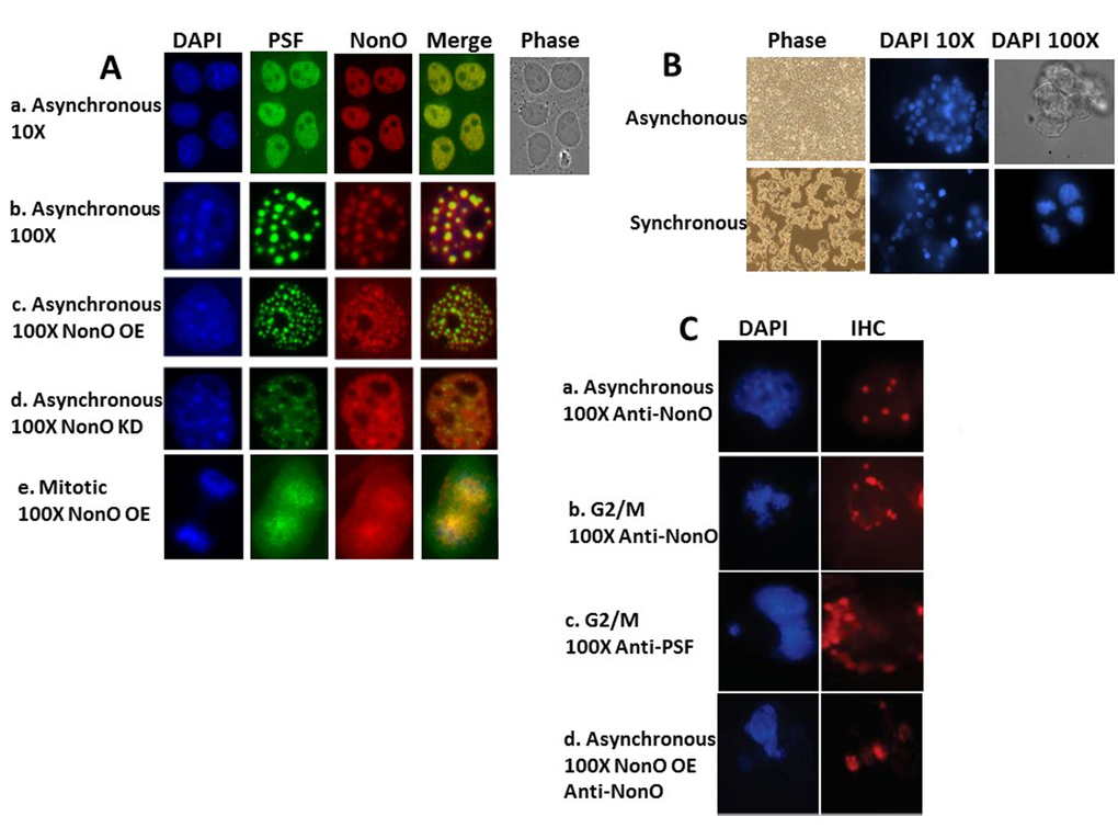 NonO-induced senescence is accompanied by cell cycle-regulated cytoplasmic localization within paraspeckles. (A) Subcellular localization of NonO and PSF in Cos7 cells as determined by Immunostaining with anti-NonO or anti-PSF antibodies. (a,b) Endogenous NonO and PSF accumulation colocalize within the nucleus in asynchronous cultures; (c) OE of NonO in asynchronous cultures increases NonO:PSF paraspeckle nuclear localization; (d) NonO knockdown reduces NonO:PSF paraspeckle nuclear abundance; (e). NonO and PSF localize both in the nucleus and cytoplasm of mitotic cells within asynchronous cultures. Cell nuclei are visualized by DAPI staining. (B) Cell synchronization of ~3 x 106 293T cells by sequential treatment with thymidine (16 h) and nocodazole (16 h) after an intermediate release step of 8 h as assessed by DAPI staining at 10X and 100X magnification. Untreated 293T cells (upper panels) grow asynchronously to confluency, whereas thymidine and nocodazole-treated cells (lower panels) loose adherence and arrest at G2/M with frequent condensed chromatin events. (C) Nuclear to cytoplasmic relocalization of NonO:PSF containing paraspeckles as identified by immunostaing with anti-NonO and anti-PSF antibodies. (a) Untreated asynchronous cultures; G2/M arrested cultures stained for NonO (b) and PSF (c); (d) Mitotic cells within asynchronous cultures follow overexpression (OE) of NonO.