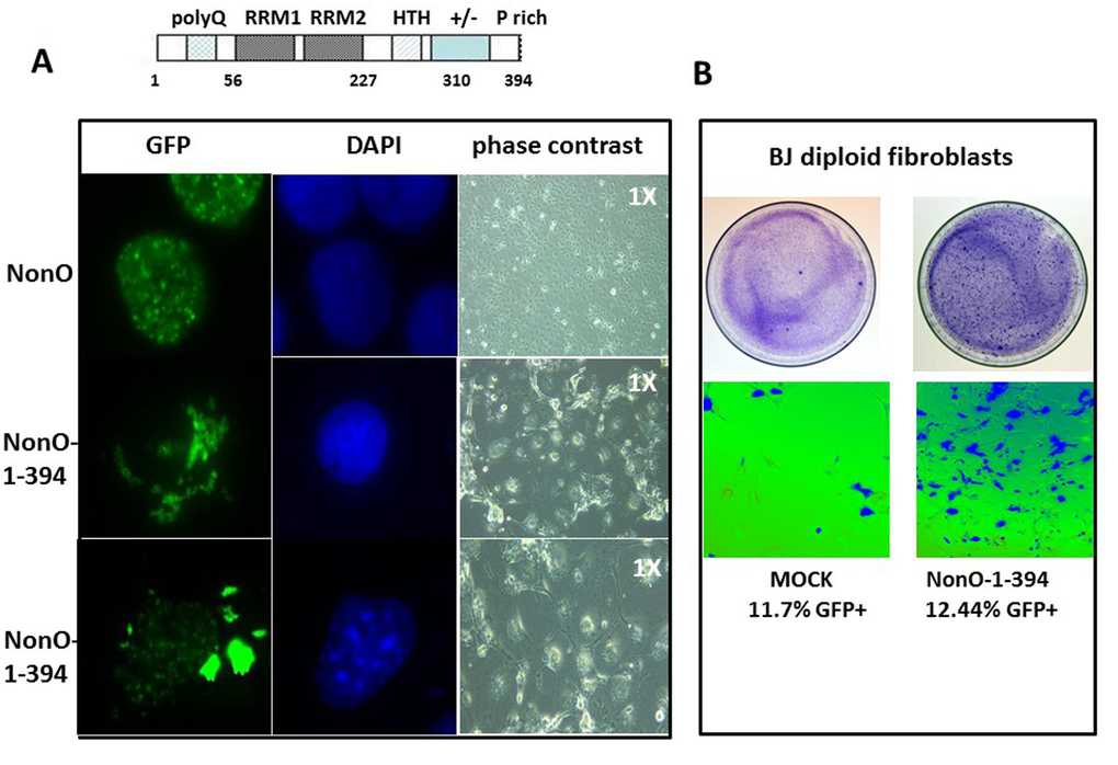 Truncation of the C-terminal 80 residues of NonO accelerates its cytoplasmic localization and senescence. (A) Subcellular localization of full-length (GFP-NonO; upper panels) and C-terminal truncated NonO(1-394) clones (middle and lower panels) imaged 12 days following overexpression (OE) in Cos7 cells by fluorescence microscopy (left), DAPI staining (middle), and phase contrast (right). (B) Overexpression (OE) of GFP-NonO(1-394) accelerates senescence of BJ diploid fibroblasts. SA-β-gal staining of plates 12 days post transfection at 1X (upper panels) and 10X (lower panels) magnification. Equivalent transfection efficiencies indicated at bottom by %GFP+ were confirmed by flow cytometry analysis (not shown).