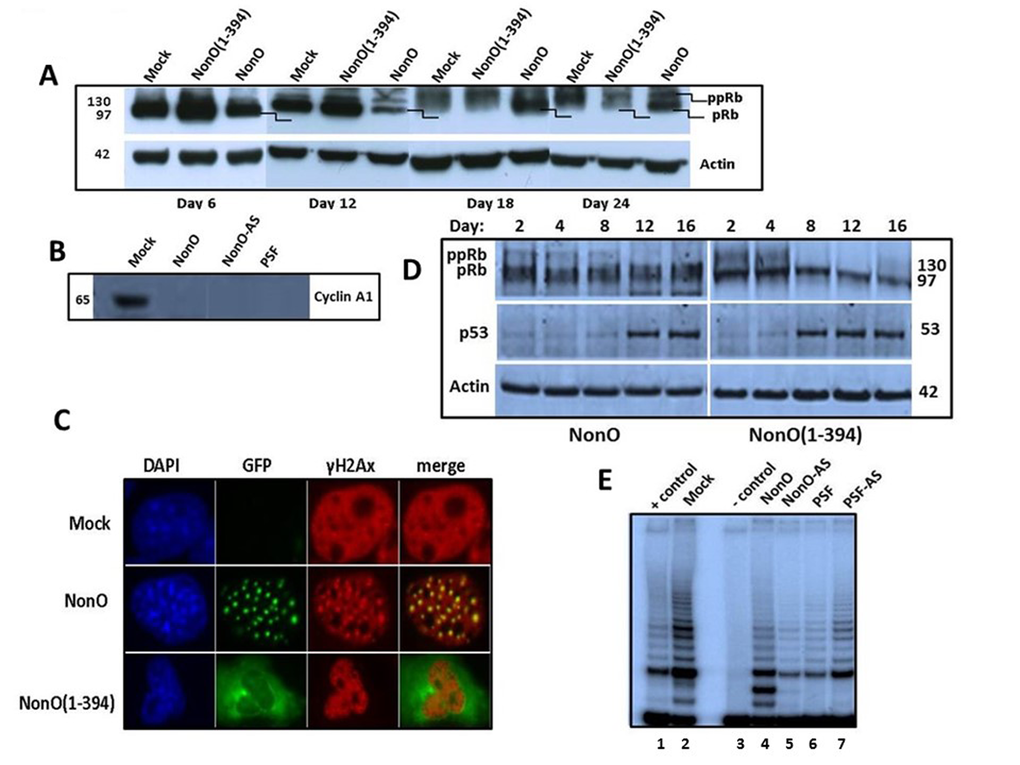 Overexpression of NonO activates G2/M arrest-associated signaling. (A) Cos7 cells were stably transfected with either truncated GFP-NonO(1-394) or full length (FL) NonO, harvested at the indicated time points, and analyzed by SDS-PAGE/western blotting with anti-Rb mAb; anti-Actin mAb served as a loading control. (B) Expression of Cyclin A1 (lower panel) and p53 (upper panel) in GFP-nonO-transfected Cos7 cells. (C) Activation of DNA damage-associated punctate γH2AX formation 12 days following overexpression (OE) of FL or NonO(1-394). In pre-senescence nuclei, γH2AX clusters overlap with NonO-containing paraspeckles (middle panels), whereas in senescent nuclei, NonO(1-394) localizes to the cytoplasm while γH2AX foci are retained in condensed nuclei (lower panels). (D) Overexpression (OE) of NonO(1-394) (right panels) induces hypophosphorylation of ppRb to pRb and upregulation of p53 more rapidly than OE of FL NonO (left panels). Actin served as a loading control (bottom panel). (E) NonO or PSF overexpression (OE) (lanes 4 and 6) or antisense (AS) knockdown (lanes 5 and 7) do not activate telomerase activity in NIH 3T3 fibroblasts. TRAP assays as well as negative (-) and positive (+) cell extract controls (Lanes 1 and 3) are described in Materials and Methods.
