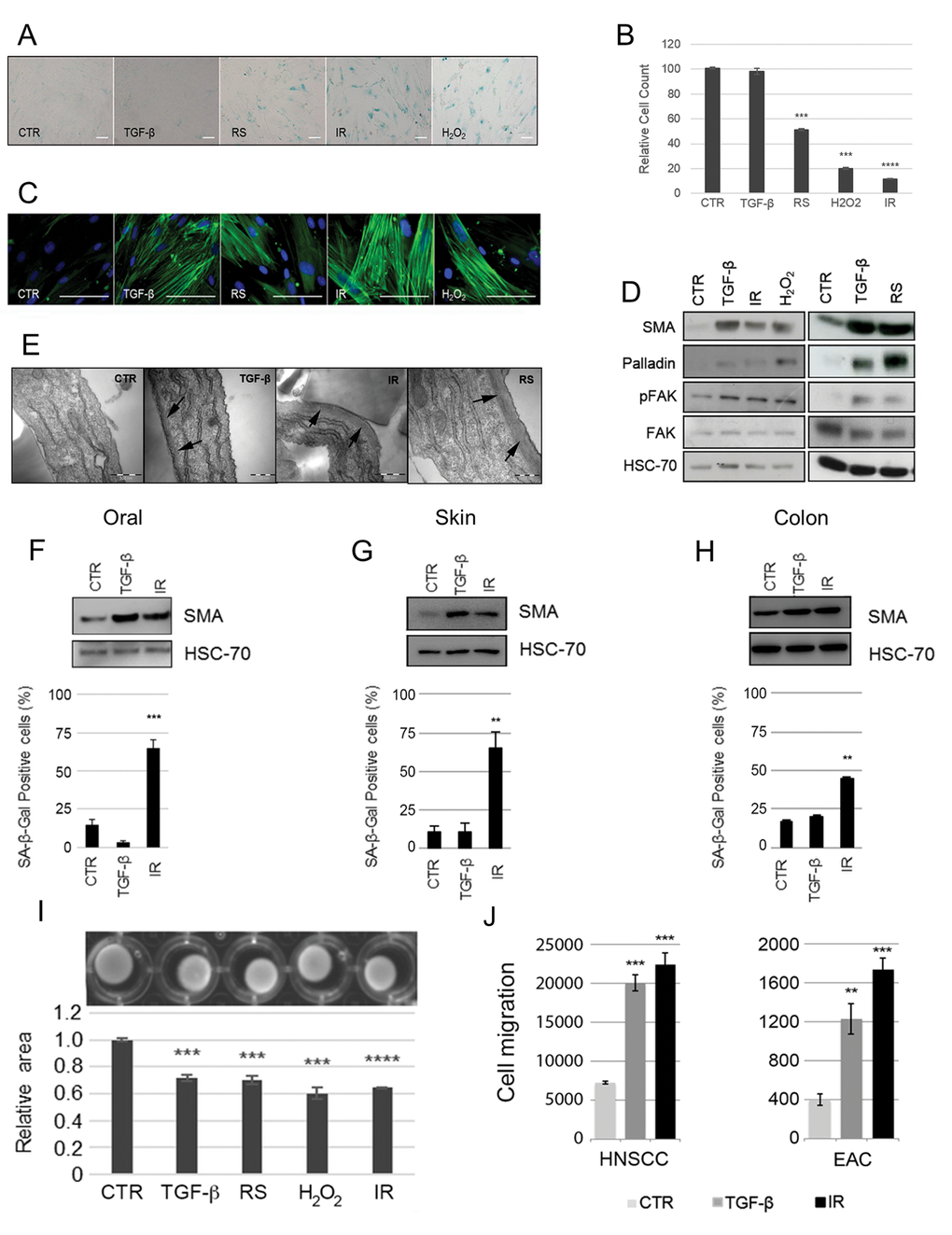 Induction of fibroblast senescence generates a myofibroblastic phenotype. HFFF2 fibroblasts were induced to senesce through serial passaging (RS), treatment with γ-irradiation (10Gy; IR) or H2O2 (1mM). Cells were treated with TGF-β1 (2ng/ml) for 72 hours to induce myofibroblast transdifferentiation as a positive control. 4-6 days post stimuli, induction of senescence was confirmed by (A) expression of SA-β-Galactosidase (SA-β-Gal; Scale Bar indicates 100µm) and (B) proliferation assays (cell counts presented as percentage of cells compared to untreated control cells; see also Supplementary Fig. S2A). Cells were examined for myofibroblast features: (C) Representative images of immunofluorescence for SMA expression (green) with DAPI nuclear counterstain (Blue) (Scale Bar indicates 100µm); (D) Western blotting for SMA, palladin and pFAK (HSC-70 as loading control); (E) Representative images of transmission electron microscopy. Arrows highlight sub-membranous microfilaments (Scale Bar indicates 50nm). (F-H) Western blotting for SMA expression (HSC-70 as loading control) and SA-β-Gal quantification following TGF-β1- and irradiation of primary fibroblasts isolated from oral, skin and colonic mucosa respectively. (I) Representative images of collagen gel contraction assays following treatment of HFFF2 with TGF-β1 or different senescence-inducing stimuli. Histogram shows quantification of gel area expressed as the mean ± SEM of 4 replicates; (J) Transwell migration assays with HNSCC (5PT) and EAC (OE33) cell lines. Conditioned media (CM) from HFFF2 fibroblasts induced to senesce through γ-irradiation (10Gy; IR) or to transdifferentiate into myofibroblasts through TGF-β1 was used a chemoattractant in the lower chamber. Data are presented as mean ± SEM and statistics are shown for T-test compared to controls (*pSupplementary Fig. S1.