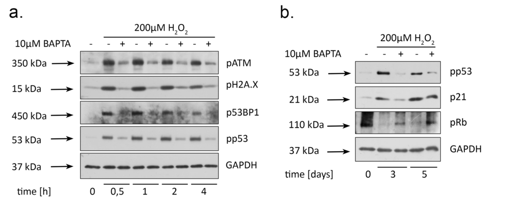 BAPTA attenuates activation of both DNA damage response and p53/p21/Rb pathway in H2O2-treated hMESCs. Cells were treated as indicated in the legend to Figure 3 and were subsequently analyzed by western blotting with the indicated antibodies at the various time points. (a) Phosphorylation levels of the main DDR members: ATM, H2A.X, 53BP1, as well as p53. (b) Western blot analysis of p53 and Rb phosphorylation, and p21 protein expression performed at indicated time points. Representative results of the three experiments are shown in the Figure. GAPDH was used as loading control.