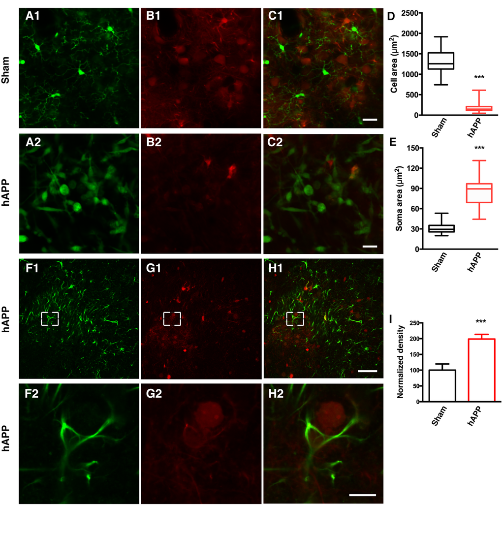 AAV-hAPP-FLAG induces microglial activation and astrocytosis.In vivo two-photon imaging of microglial activation in AAV-hAPP-SLA injected CX3CR1-GFP+/- mice. (A1-A2), GFP expressing microglial cells, (B1-B2), tdTomato and (C1-C2), merged. (1) Sham-operated mice indicating microglia cells in resting state, (2) AAV-hAPP-SLA injected mice indicating microglia cells in an activated state. Mean cell area (D) and mean soma area of microglia cells (E) in the sham and AAV-hAPP-SLA injected mice (Student’s test, P F-H) Representative images showing GFAP immunostaining in the PFC. Immunofluorescence images at low (1) and high (2) magnification for GFAP (F), Aβ oligomers (G) and merged (H). (I) Quantification of GFAP density. The density was normalized to control levels. The error bar is ± SEM. (Student’s test, P 