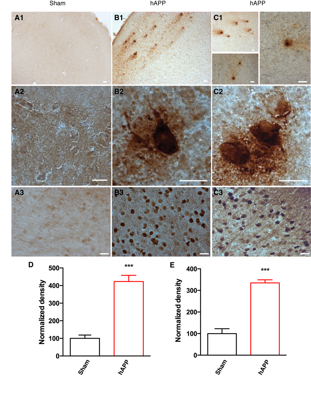 Detection of amyloid plaques and NFTs in the PFC of AAV-hAPP-SLA injected mice at 12 mpi. (A) Sham mouse brains injected with a control AAV and (B), (C) AAV-hAPP-SLA injected mice stained with the 4G8 antibody (1, 2) and AT100 antibody (phospho-tau at Ser212 and Thr214) (3). Scale bars = 20 µm. Quantification of 4G8 optical density (D) and AT100 densities (E) and normalized to values obtained in sham operated mice. The error bar is ± SEM. (Student’s test, P 
