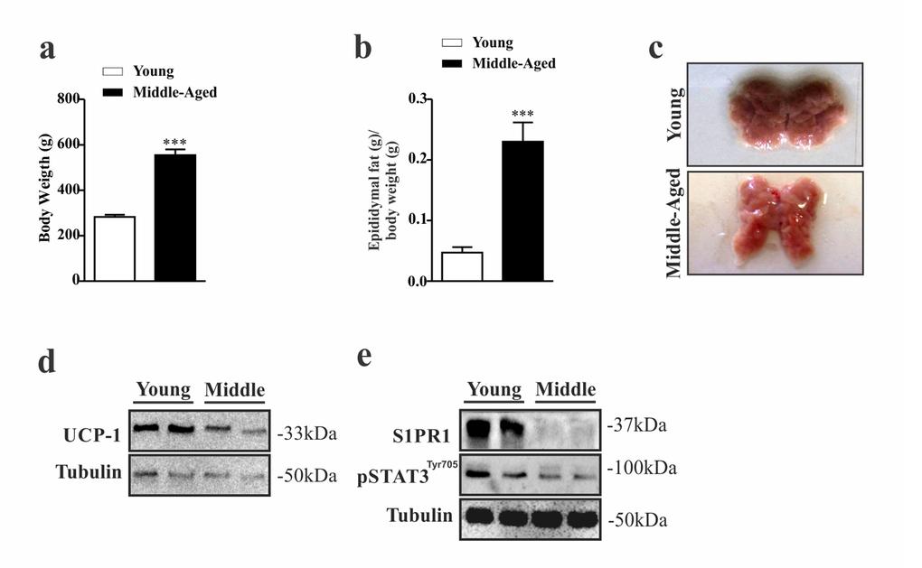 Evaluation of S1PR1/STAT3 axis in the hypothalamus of middle-aged rats. Body weight (a) (n=6–8 per group) and epididymal fat pad weight (b) (n=5 per group). Image of BAT (n=6 per group) (c). Representative Western blots show: UCP1 expression (d) S1PR1 protein expression and STAT3 tyrosine phosphorylation in hypothalamus (e) in young and middle-aged rats. Rats were fasted for 10 hours prior to extraction of the hypothalamus for Western blots analysis (n=6 per group). The Student’s t-test was performed to evaluate data. means ± SEM are shown in (a) ***p