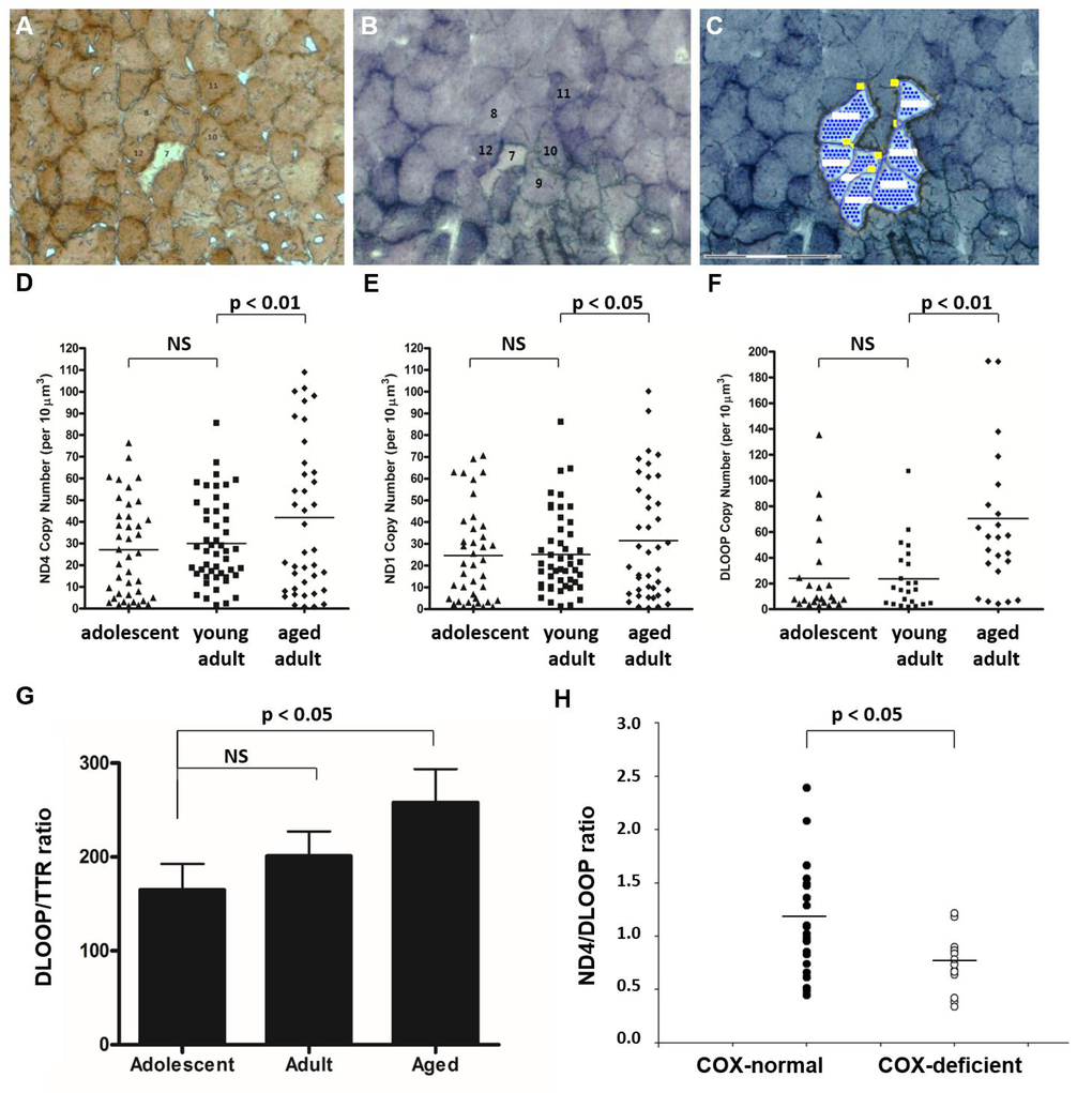 Total mtDNA copy number is significantly increased in aged skeletal muscle fibers. NMR quadriceps muscle fibers with normal enzyme activity (such as Cells #11 and #12) were identified in COX-stained sections (A), correlated with SDH-stained sections (B), and laser-capture micro-dissected (C). mtDNA copy number was quantified by real-time PCR-based amplification of various regions of the mitochondrial genome. Total copy number in these cells, normalized to cell area, increased significantly in aged animals compared with young adult animals in all three regions quantified: ND4 (D, pE, pF, pG). The few COX-deficient cells observed in aged NMR skeletal muscle (such as Cell #7) were laser-capture micro-dissected from SDH-stained serial sections and subjected to multiplexed real-time PCR to quantify the ratio of ND4 (a commonly deleted region) with DLOOP (the control region). COX-deficient cells from aged quadriceps muscle have a significantly lower ND4/DLOOP index than normal cells in aged quadriceps muscle (H).