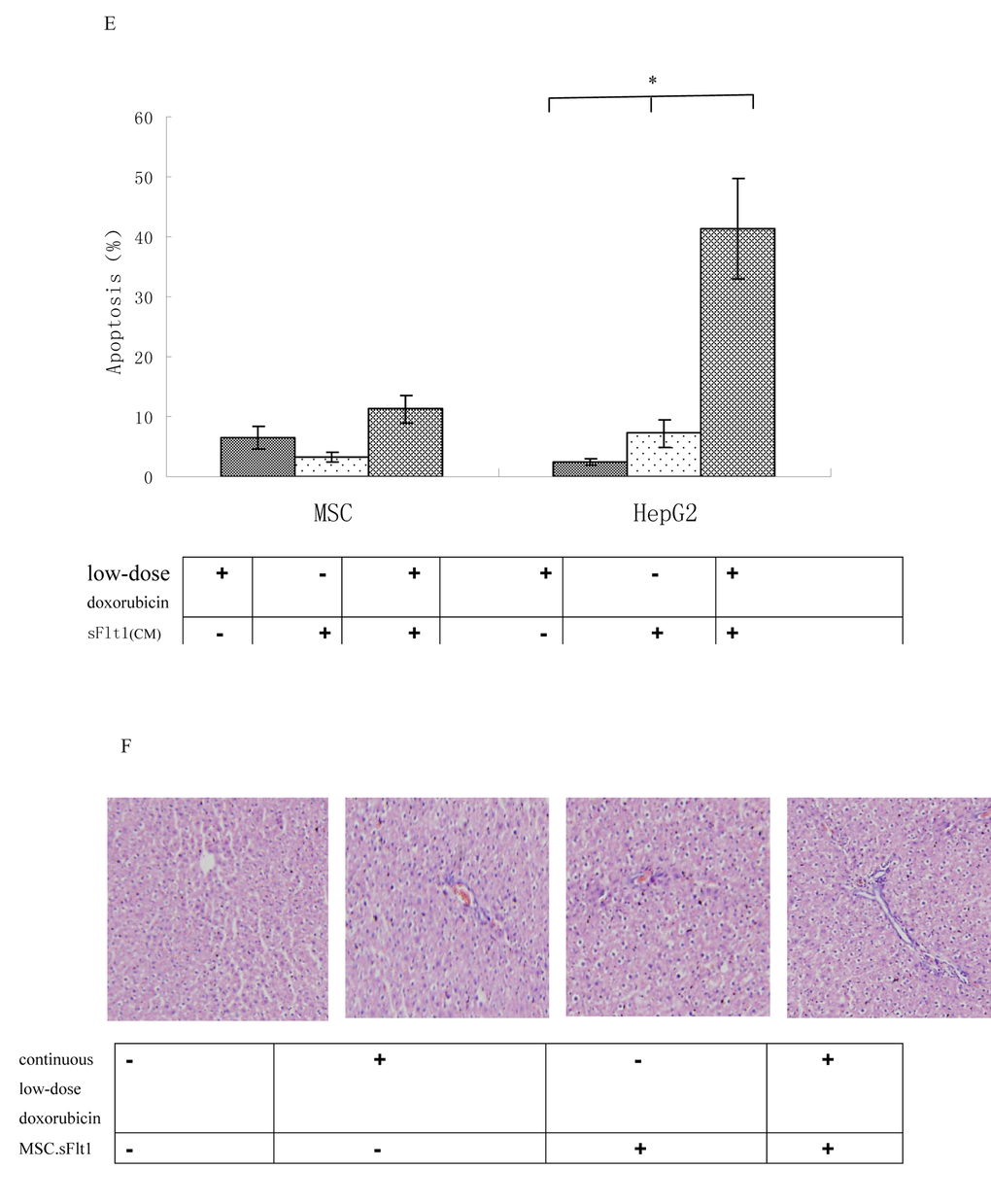 Apoptosis was measured after exposure of MSCs or HepG2 cells to 0.02μM doxorubicin plus sFlt1 (1.0 ml of concentrated conditioned medium) for 48 h. *p F) HE staining of liver sections from mice treated with saline, continuous low-dose doxorubicin, MSC.sFlt1 and MSC.sFlt1plus continuous low-dose doxorubicin, respectively. Magnification, 200×.