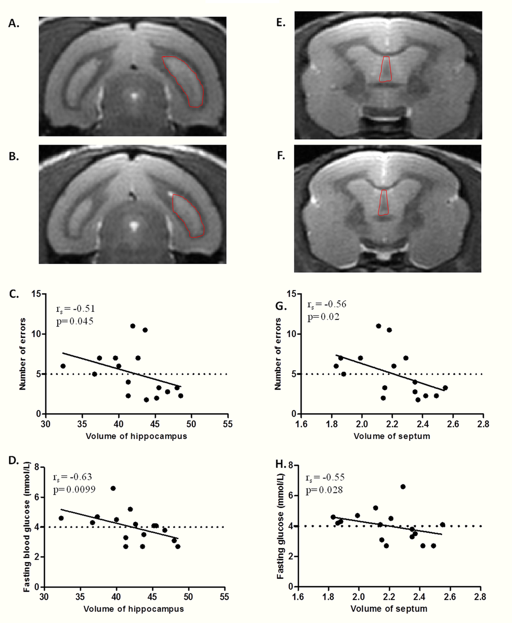 Relationship between fasting blood glucose, hippocampus/septum volume, and spatial memory performance in middle-aged lemurs. (A-B) MRI coronal sections of hippocampus (right hippocampus outlined by dotted line) in a non atrophied middle-aged (A) and an atrophied middle-aged (B) mouse lemurs. (C) Spearman correlation between number of errors and hippocampus volume. (D) Spearman correlation between fasting blood glucose and hippocampus volume. (E-F) MRI coronal sections of septum (outlined by dotted line) in a non atrophied middle-aged (E) and an atrophied middle-aged (F) animals. (G) Spearman correlation between number of errors and septum volume. (H) Spearman correlation between fasting blood glucose and septum volume.