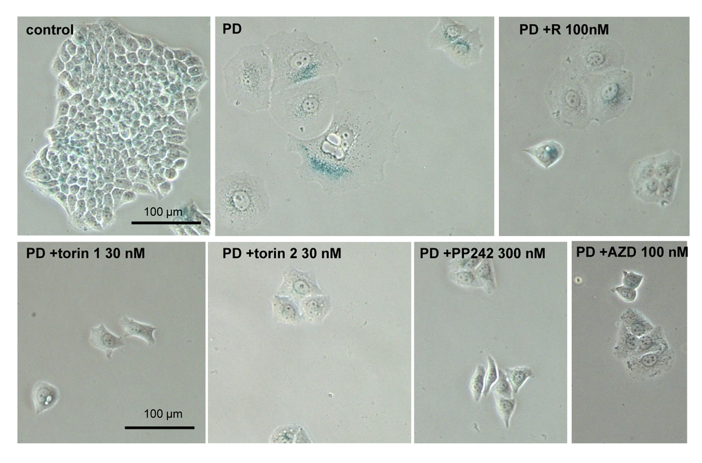 Effect of TORINs on senescent morphology of SKBR3 cells induced to senesce by treatment with PD0332991. Cells were treated with selected concentrations of TORINs and 10 µM PD0332991 (PD). After 4-day treatment drugs were washed out and cells were incubated in drug free medium for 2 days and stained for SA-beta-gal. Bar – 100 µm.