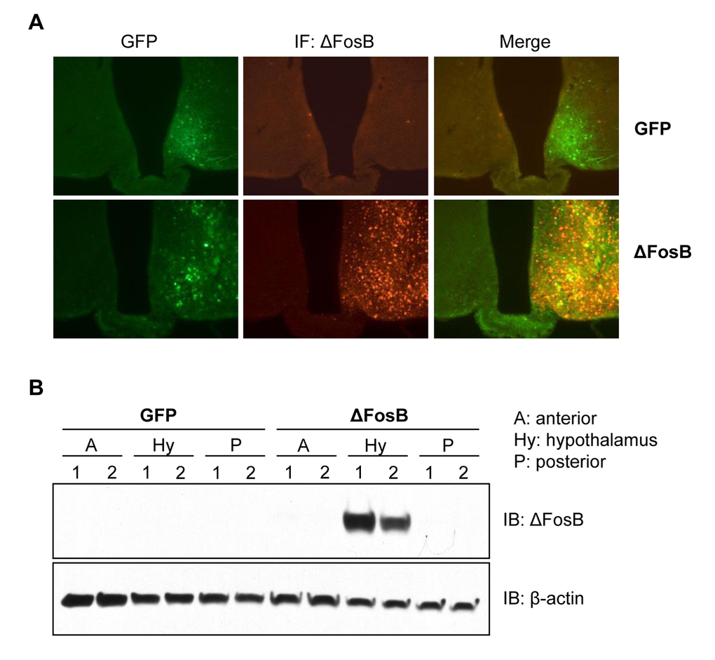 Site specific overexpression of ΔFosB in the VHT. Mice received stereotaxic injections of either AAV-ΔFosB or AAV-GFP. Only right hemisphere was injected with viruses, left hemisphere was injected with saline (sham) and sacrificed 1 week post-surgically (n=3). Brain frozen sections were subjected to histological analysis (A) Immunofluorescent staining with anti-ΔFosB antibody followed by Alexa-fluor568 conjugated secondary antibody (red). Green fluorescence originates from ires-GFP-AAV backbone. X100 magnification. (B) Western blotting of gross brain sections with anti-ΔFosB using β-actin as housekeeping control. Blots of two mice per virus were shown.