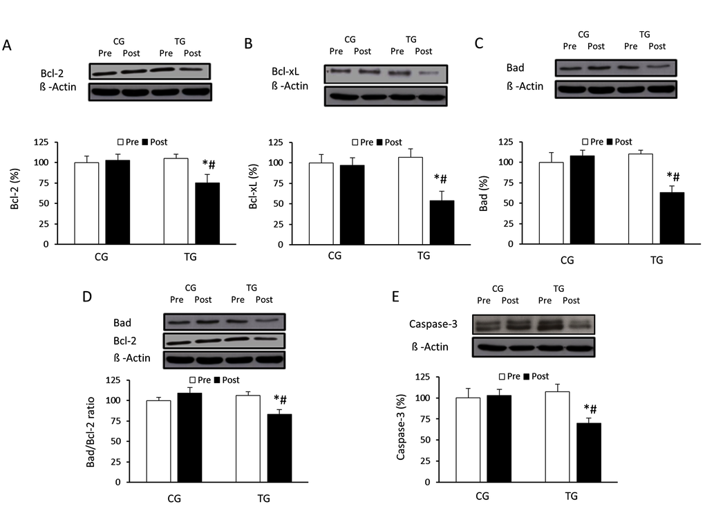 Effects of resistance training on BcL-2, Bcl-xL, and Bad expression and cleaved caspase-3. Representative Western blots and densitometric quantification of Bcl-2 (A), Bcl-xL (B), and Bad (C), Bad/Bcl-2 ratio (D) and cleaved caspase-3 (E) in PBMCs in response to 8 weeks of resistance training for TG and the same period of normal daily routines for CG. Protein from PBMCs was separated by sodium dodecyl sulfate-polyacrylamide gel electrophoresis, followed by immunoblotting. Equal loading of proteins is illustrated by β-actin bands. Values are means ± SEM.*pvs. CG; #pvs. Pre within a group.