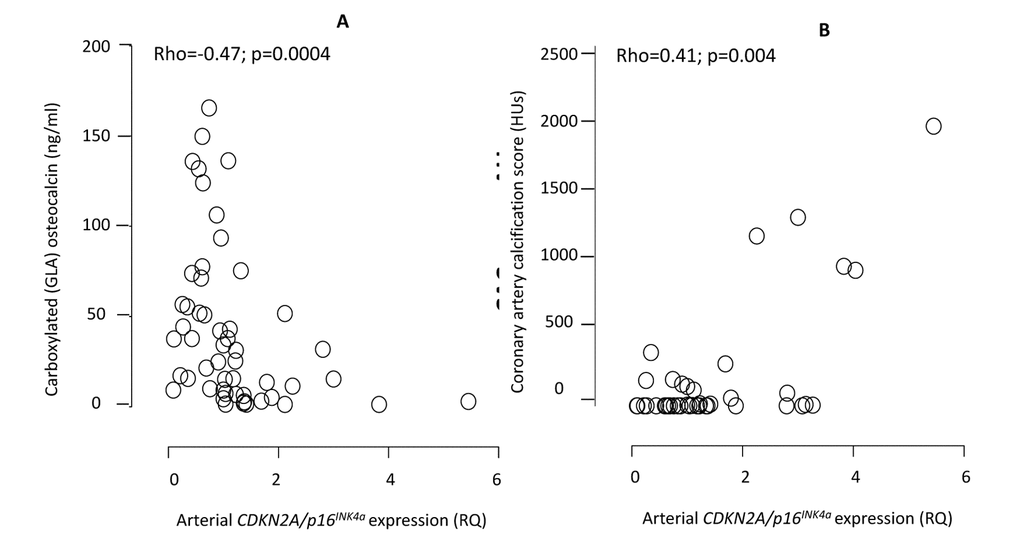 Correlations between the arterial expression of CDKN2A/p16INK4a and circulating levels of carboxylated (GLA) active osteocalcin (A) and coronary artery calcification by CT heart (B). CDKN2A = cyclin-dependent kinase 2A. RQ = relative quantity. HU = Hounsfield units. The exclusion of one patient on warfarin did not affect the correlation between CDKN2A/p16INK4a and GLA-OC (Rho=-0.51; p=0.001).