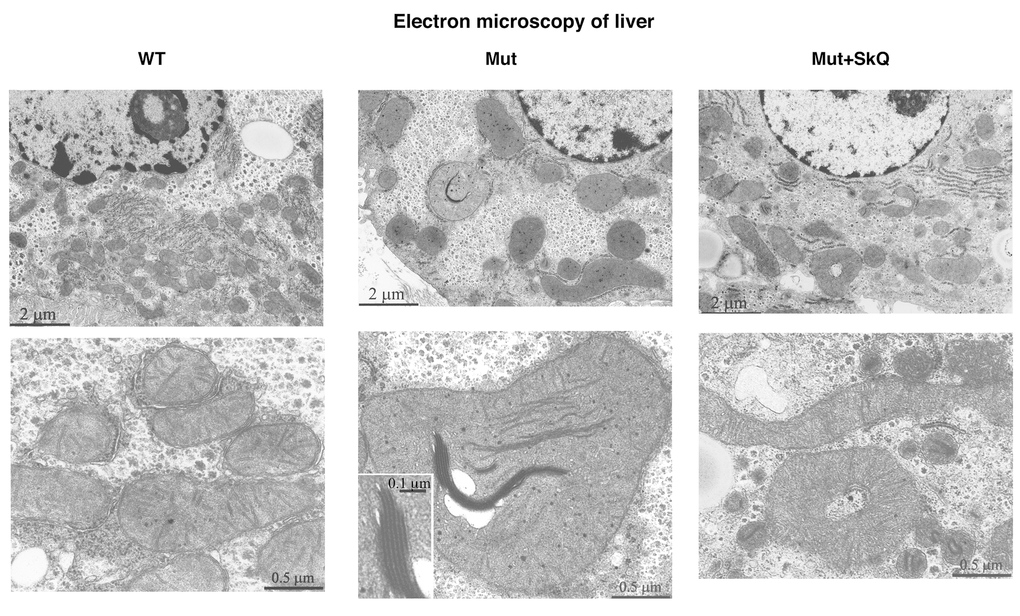 Liver mitochondrial structure. Electron micrographs of liver from wild-type mice (left panel), mtDNA mutator mice (middle panel) and mtDNA mutator mice treated with SkQ1 (right panel). Animals were 245 – 252 days old. Insertion in the middle panel, lower micrograph: intramitochondrial myelin-like structure at higher magnification. Similar findings were observed in 4-5 other mice of each group.