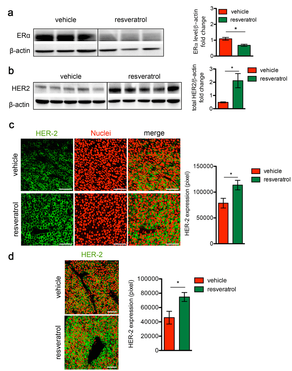 Resveratrol treatment induces HER2 over-expression and ERα down-regulation in HER2+/ERα+ mammary carcinomas. (a) Representative western blot analysis of ERα and β-actin (loading control) in spontaneous mammary tumors from Δ16HER2 mice supplemented or not with resveratrol (left panel), and relative densitometry quantification from three independent experiments (right panel). The significance was determined by unpaired two-tailed student t test, *p b) Representative western blot analysis of HER2 and β-actin (loading control) in spontaneous mammary tumors from Δ16HER2 mice, supplemented or not with resveratrol (left panel), and relative densitometry quantification from three independent experiments (right panel). The significance was determined by unpaired two-tailed student t test, *p c) Left panel: representative immunofluorescence images of tumor sections from control and resveratrol supplemented mice stained with an antibody anti-HER2 (green) and DRAQ5 dye (red) for nuclei staining. Magnification 400 X. Right panel: quantification of HER2 staining in tumors from resveratrol and vehicle treated mice. Data are expressed as mean ± SEM. *p d) Resveratrol treatment induces HER2 over-expression in lung metastases. Left panel: representative immunofluorescence images of lung metastasis sections from control and resveratrol supplemented mice stained with an antibody anti-HER2 (green) and DRAQ5 (red). Magnification 400 X. Right panel: quantification of HER2 staining in tumors from resveratrol and vehicle treated mice. Data are expressed as mean ± SEM. *p 