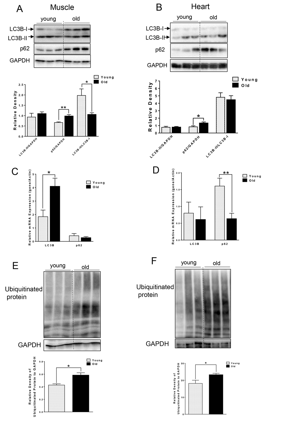 Accumulation of p62 and ubiquitinated proteins in old skeletal and cardiac muscle. (A-B) Immunoblot and densitometric analysis of LC3B and p62 in young and old skeletal muscle (A) and heart (B). (C-D) mRNA expression of LC3B, p62 in young and old skeletal muscle (C) and heart (D). (E-F) Immunoblot and densitometric analysis of ubiquitinated proteins in young and old skeletal muscle (E) and heart (F). Values are means±SEM for 6 young and 5 old mice in each group. *P 