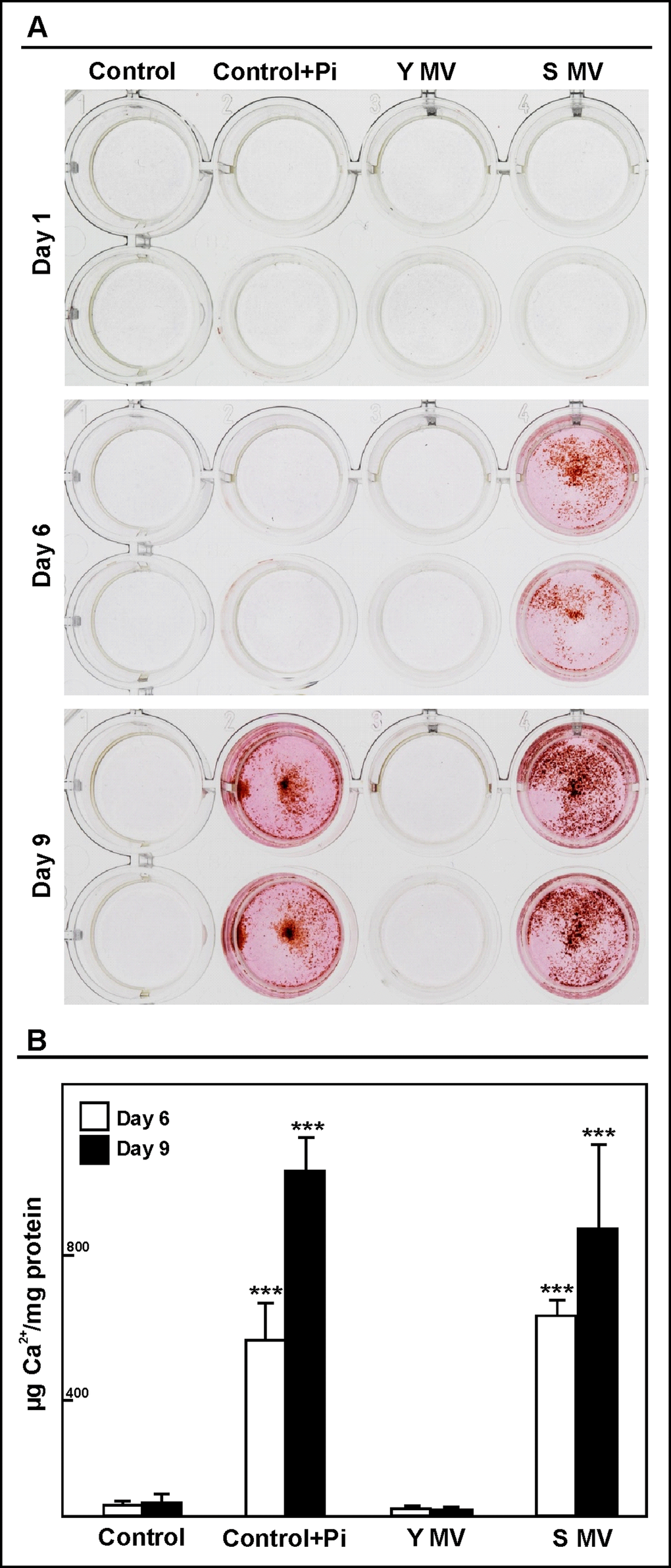 MVs from senescent HUVEC cells induced calcification in HASMC. Cells were cultured with 50,000 MVs/mL from young (Y MV) or senescent (S MV) HUVEC for different times. (A) Qualitative calcification was stained with alizarin red. A representative experiment from six different experiments per duplicate is show. (B) Calcium content was determined by spectrophotometer by phenolsulphonephthalein dye at 6 and 9 days of treatment. The graphs present calcium content of the cells expressed as µg/mg protein. The data represent means ± SD of 3 independent experiments. *** p