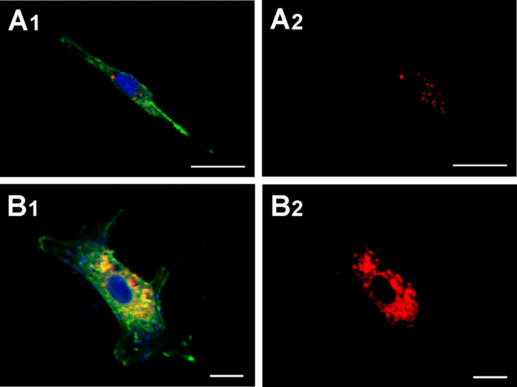 Capture of MVs by HASMC. Cells were incubated for 48 h with MVs from young (panels A1 and A2) or senescent HUVEC (panels B1 and B2) stained with CellTracker CM-Dil PI (red) and then were stained with phalloidin (PKH67, green). Nuclei were stained with DAPI (blue). Fluorescence was evaluated by confocal microscopy. (A) Scale bar 25µm, and (B) scale bar 10 µm. A representative experiment from three different experiments is shown.