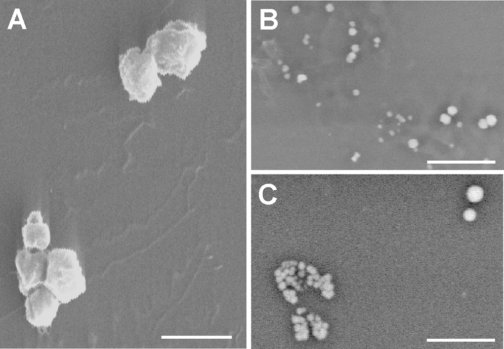 Scanning electron microscopy. (A) Gold-palladium coated senescent MVs. Scale bar 1μm. Note the poly-L-lysine layer. (B and C) Young MVs prepared without metal coating. Note the heterogeneous size and brightness. Scale bar 5μm. The background noise of some pictures a consequence of the fast scanning speed.