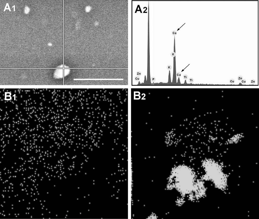 Spot mode microanalysis of an MV (A1) with its corresponding plot (A2); arrows indicate Ca spikes. Scale bar 5μm. Larger MVs are usually brighter and have a higher Ca content. Ca mapping of MVs from (B1) young and (B2) senescent HUVEC. Ca is seen as grey on the black background.