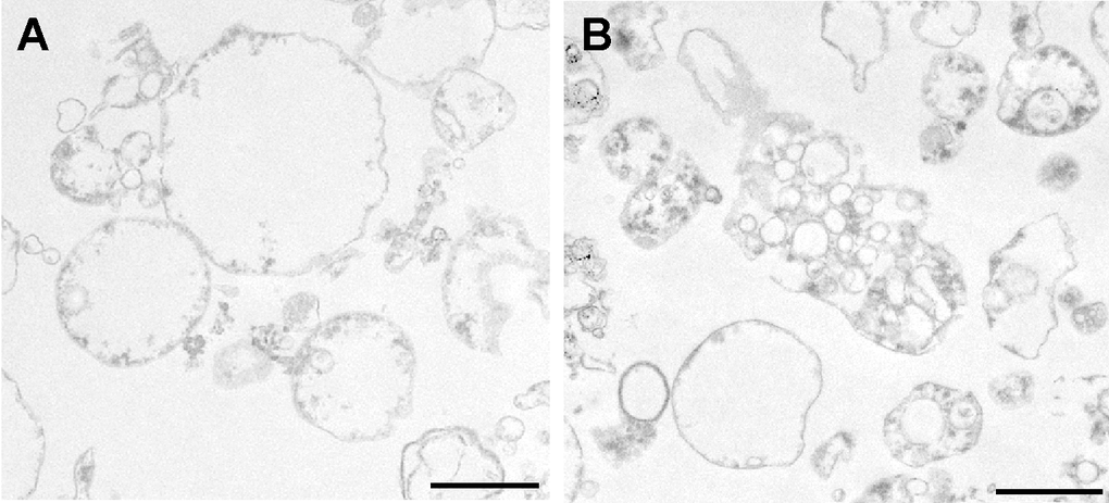 TEM analysis of MVs from (A) young and (B) senescent HUVEC.