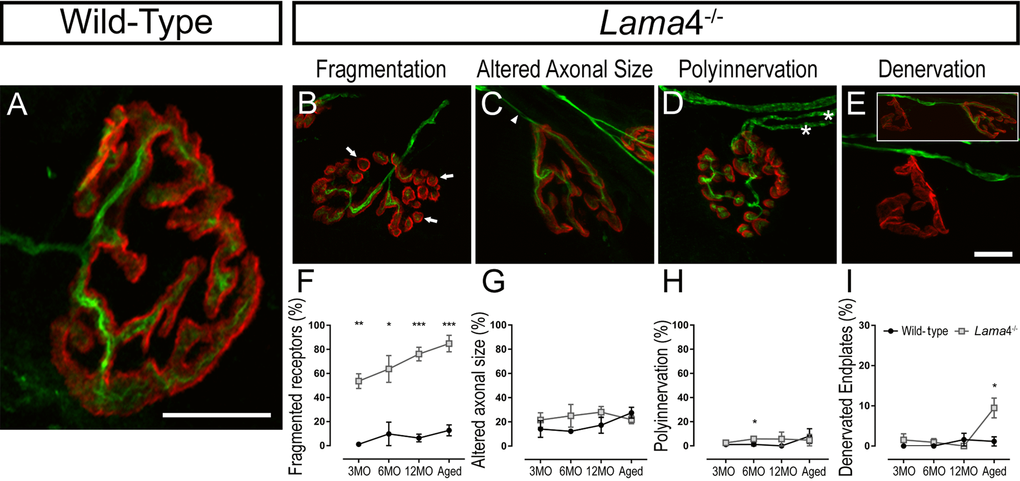 Accelerated aging features at lama4-/- neuromuscular junctions in EDL muscle. (A-E) Representative staining of axons and nerve terminal (green) in relation to the postsynaptic endplates (red) in WT (A) and lama4-/- (B-E) at 3MO. WT (A) showed normal innervation pattern while lama4-/- NMJs had (B) fragmented islands of postsynaptic receptors (as indicated by arrows), (C) altered innervating axonal size with thinning (as indicated by arrowhead) with some endplates displaying swollen axons, (D) polyinnervation or multiple axons entering the nerve terminal (as indicated with asterisks) and (E) completely denervated endplate with a smaller insert panel showing an occupied endplate alongside the denervated endplate. Scale bar = 10 µm. Quantification of aging features; (F) fragmented endplates, (G) altered axonal size, (H) polyinnervation and (I) denervated endplates across all ages. (F-I) n = 3, NMJs = 63-109 per genotype at each age group. Statistical analyses were performed using Student’s t-tests; values are presented as mean ± SEM (* P P P 