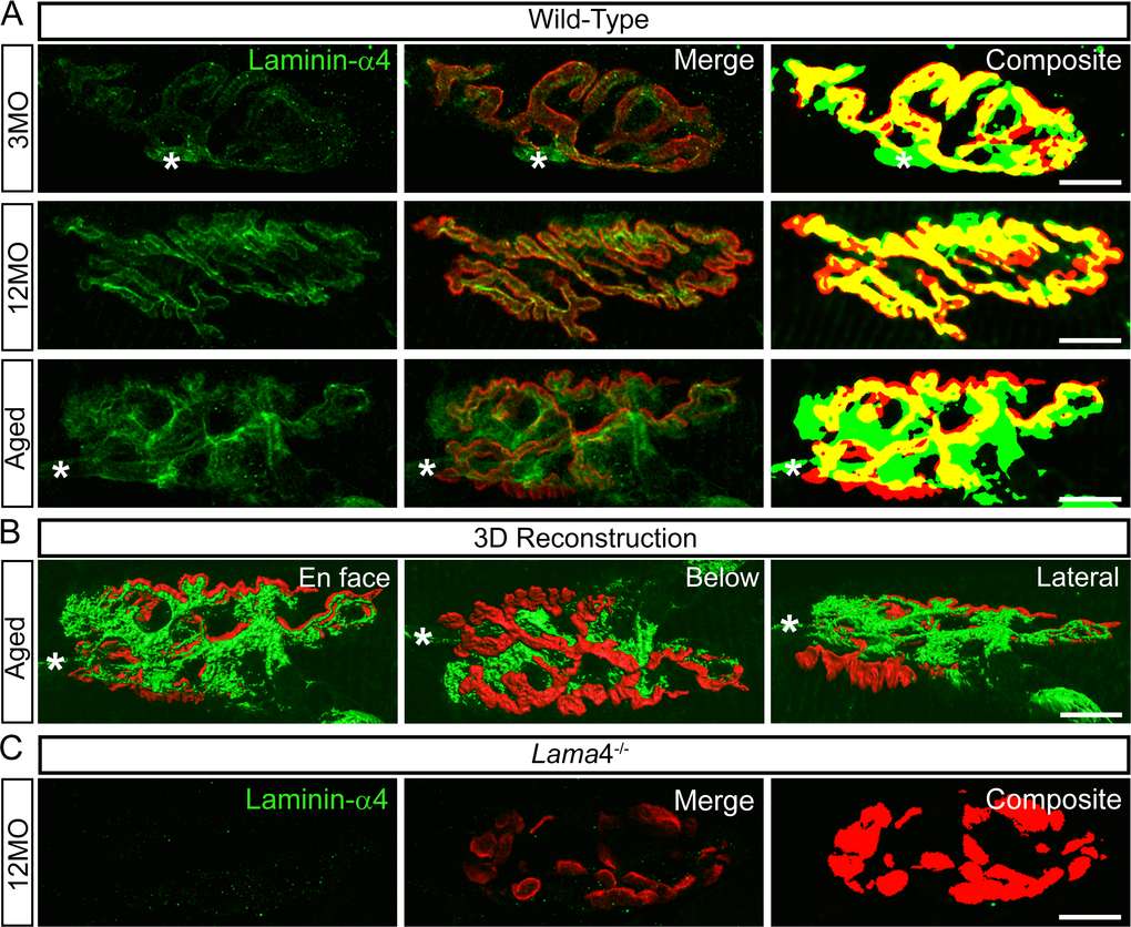 Altered expression of laminin-α4 at 12MO wild-type NMJs, becoming more evident at aged neuromuscular junctions. (A) Examples of representative staining of laminin-α4 chain (green) with respect to the postsynaptic endplates (red) in EDL muscle. Composite panel showed colocalization of laminin-α4 with postsynaptic endplate = yellow, extrasynaptic localization of laminin-α4 = green and missing laminin-α4 expression at postsynaptic region = red. Asterisk (*) is an indication of a nerve entering the nerve terminal, therefore it is not considered as an extrasynaptic localization of the laminin-α4 chain. WT at 3MO showed normal colocalization of laminin-α4 chain with respect to the postsynaptic endplates. By 12MO, WT began to display missing expression of laminin-α4 (observed with more red on composite panel) and mislocalized laminin-α4 expression (more green) compared with 3MO WT. As the NMJ aged, WT showed drastic changes in laminin-α4 expression with highly expressed laminin-α4 at the extrasynaptic region (high degree of green) and lacking laminin-α4 (high degree of red) compared with 12MO WT. The overlapping of laminin-α4 to postsynaptic endplates (yellow) at aged WT NMJ was at a much lesser degree in comparison with 12MO WT. (B) 3-dimensional (3D) reconstruction of laminin-α4 staining (green) in relation to postsynaptic endplate (red) of aged WT NMJ from (A), in three different planes of view; en face, below and lateral. En face view is reflective of the image shown in (A). Below and lateral views confirmed that non-colocalized laminin-α4 staining was purely expressed at the extrasynaptic basal lamina region, not by non-muscle cells. (C) Lama4-/- NMJs at 12MO displayed no expression of laminin-α4 chain. Scale bar = 10 µm.