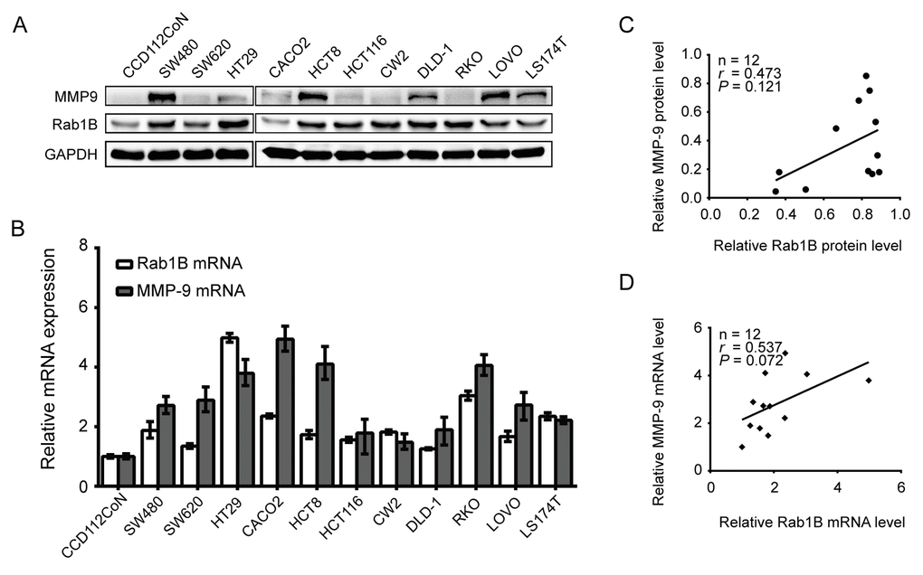Rab1B and MMP9 are overexpressed in CRC cell lines. (A) The expression of Rab1B and MMP9 proteins in a panel of CRC cell lines and an immortalized colon cell line is determined by immunoblot. GAPDH is used as a loading control. (B) Relative expression of Rab1B and MMP9 mRNA (normalized to GAPDH) in the same set of cell lines as in (A) is examined by real-time quantitative PCR. (C) The correlation between Rab1B and MMP9 proteins (normalized to GAPDH) in the CRC cell lines was determined by Spearman correlation assay. (D) Spearman correlation analysis is used to analyze the correlation between Rab1B and MMP9 mRNAs in CRC cell lines.