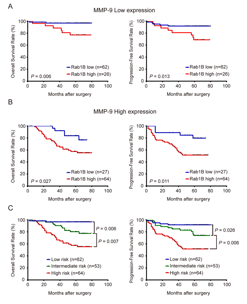 Combined overexpression of Rab1B/MMP9 further improves predictive efficiency for outcome of CRC patients. (A) OS and PFS of patients with high or low Rab1B expression in those with low-expression of MMP9. (B) OS and PFS of patients with high or low Rab1B expression in those with high-expression of MMP9. (C) OS and PFS of patients who were stratified into three risk groups by the combined risk score of Rab1B and MMP9 proteins. Kaplan-Meier survival was used to predict the outcomes of CRC patients with low, intermediate or high combined risk score.