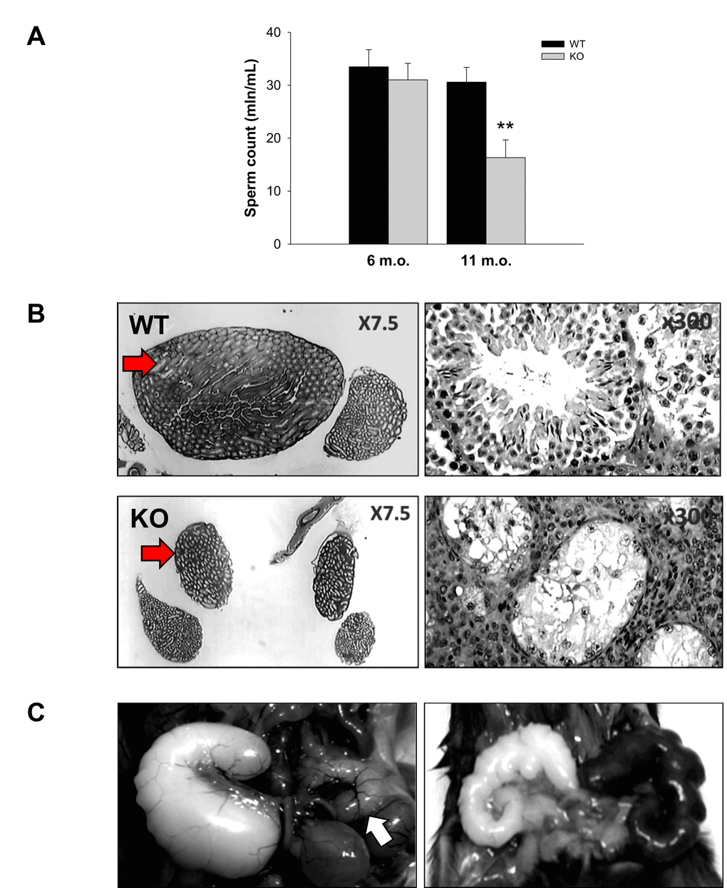 Prematurely developed low sperm count, occasional testes degeneration or vesicle enlargement observed in Fus1 KO but not in WT mice. (A) Sperm count in WT and Fus1 KO mice of different ages (6 m.o.: WT mice, n = 10, KO mice, n = 9; 11-12 m.o.: WT mice, n = 6; KO mice, n = 9) revealed a premature sperm count decrease in 11-12 m.o. Fus1 KO mice; (B) Unilateral (not shown) and bilateral testes degeneration (shown at x7.5 and x300 magnification) were observed occasionally in adult Fus1 KO but not in WT mice. Arrows point to a normal testis from a WT mouse and a degenerated one from a Fus1 KO mouse; (C) Enlargement of seminal vesicles, an aging lesion that occurs spontaneously in some mice aged 24 mo or older were found in Fus1 KO mice of 16-20 months old. Lesions of different types were observed: asymmetrical vesicle enlargement (left), a normal size vesicle is shown by the arrow; symmetrical enlargement and discoloration of vesicles (right); symmetrical vesicle enlargement (not shown).