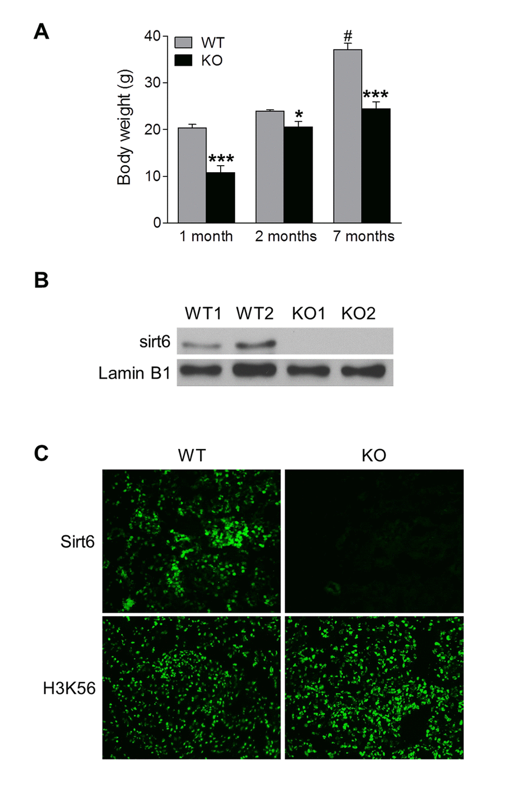 Functional Sirt6 is expressed in mouse kidney. (A) Body weight of Sirt6 KO mice and their WT littermates was quantified at various ages. Data are presented as mean ± SEM; n=8-9; *P#PB) Nuclear protein was extracted from the kidneys of WT and Sirt6 KO mice and Sirt6 protein expression was assessed by Western blot analysis. Lamin B1 served as loading control. (C) Immunofluorescence of Sirt6 and H3K56 in kidney cryosections from WT and Sirt6 KO mice.