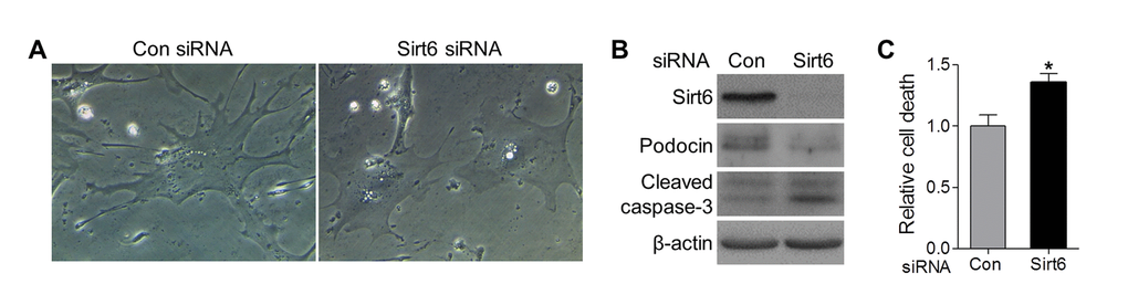 Sirt6 knockdown impairs foot process and induces podocyte apoptosis in vitro. Primary murine podocytes were plated in a collagen coated 12-well plate at a density of 6x104 cells/well and transfected with Sirt6 or control siRNA. (A) Two days after transfection, images of cell morphology change were taken by light microscope. (B, C) Three days after transfection, cells were harvested for western blot (B) and Cell death ELISA (C). Data are presented as mean ± SEM; n=3; *p