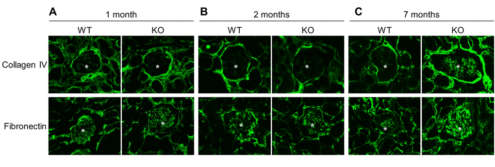 Sirt6 deficiency increases fibrosis. Kidney cyrosections from WT and Sirt6 KO mice at different ages were stained with antibodies against collage type IV and fibronectin (green). Images were taken at 200X by fluorescence microscopy. Stars indicate glomeruli.