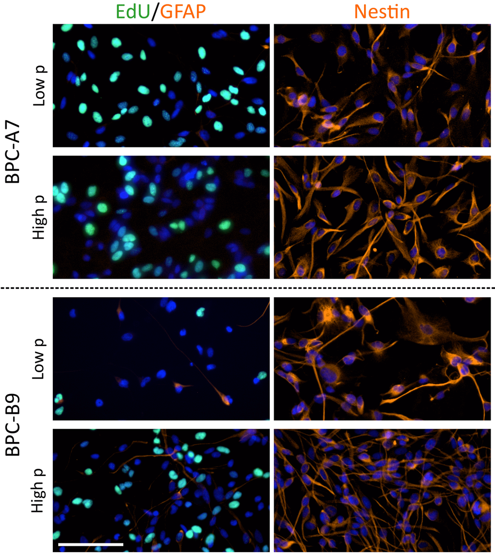 The pediatric tumor cells retain stem cell markers and are proliferative in higher passage. The cell lines BPC-A7 and BPC-B9 are proliferative (EdU labeling) also in high passage (p) and have similar expression of the astrocyte marker GFAP in low and higher passage. The stem cell marker nestin is expressed in low passage and retained in high passage demonstrating that the cells are stable in culture. The scale bar is 100 µm.