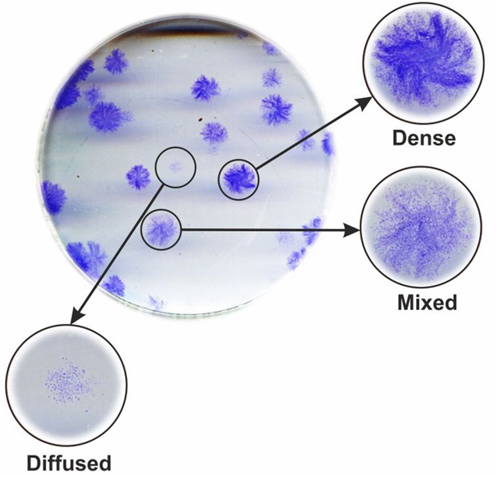 Different colony phenotypes. Colonies were phenotyped based on the density of the stain. Typical examples of the three phenotypes are shown.