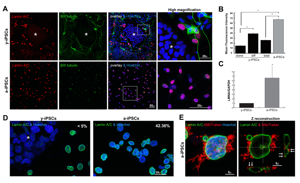 Behaviour of lamin A/C, nucleoskeleton and mitochondria in iPSCs, in pluripotent state and following differentiation and senescence. (A) Lamin A/C and β-III tubulin staining was absent in y-iPSCs of the colony (asterisk), but normally detectable upon differentiation (red nuclei). Lamin A/C strongly increased in aged cells, whereas β-III tubulin was faintly present (right column: high magnification of the inset). (B) Mean fluorescence intensity of lamin A/C immunostained nuclei in colony (clone) and differentiated (diff) cells from y-iPSCs and from a-iPSCs nuclei. Data are presented as the mean ± SEM (*: p C) RT-PCR analysis of LMNA mRNA expression in y-iPSCs and a-iPSCs. Reduced levels of lamin A/C are associated with the youth and stemness (*: p D) Increased nuclear dysmorphisms were found in a-iPSCs. (E) Abnormal accumulation of mitochondria was noticed in association with nucleoskeletal alterations in senescent iPSCs (arrows).