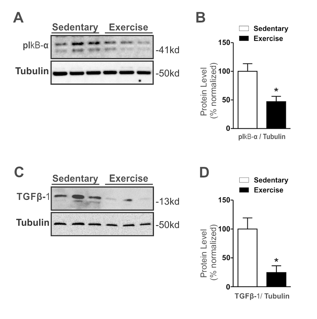 Effects of chronic exercise on hypothalamic TGF-β1 protein levels in Middle-Aged obese mice. Western blotting of IkB-α ser32 phosphorylation (A) and TGF-β1 protein level (C) and Protein level normalization with Tubulin (right) (B and D) (n= 8 per group). All analyses were made after the last day of training. Data are expressed as means ± SEM. *, p
